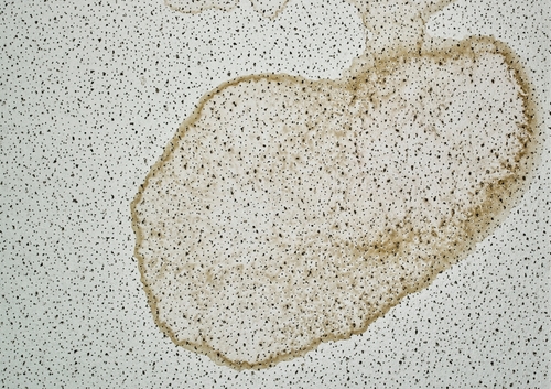 What are the standards for mold exposure